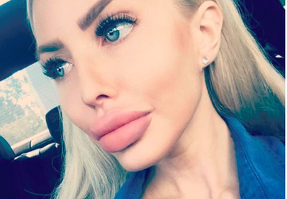Anella Anella