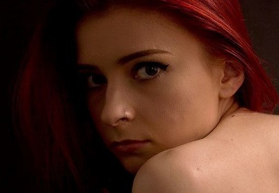 Rebecca Dann z kifozą Rebecca Dann z kifozą