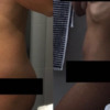 brzuch blogerki chorującej na endometriozę brzuch blogerki chorującej na endometriozę