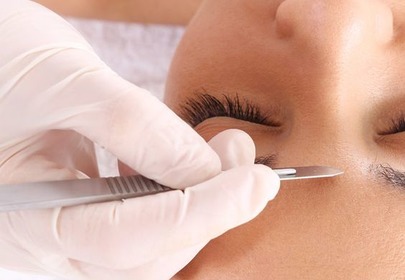 Dermabrazja manualna Dermabrazja manualna