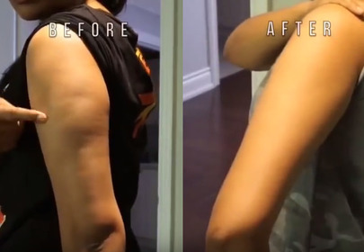 Ręka przed i po zastosowaniu body wrapingu z miodem, wodorowęglanem sodu, kawą i algami Ręka przed i po zastosowaniu body wrapingu z miodem, wodorowęglanem sodu, kawą i algami