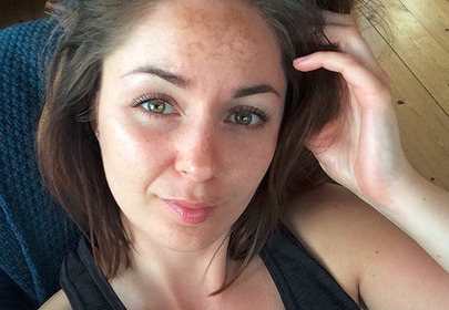 dziewczyna z przebarwieniami na twarzy selfie dziewczyna z przebarwieniami na twarzy selfie