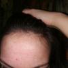Zdjęcie do recenzji Niedrogi wysyp baby hair. od użytkownika raw25plus